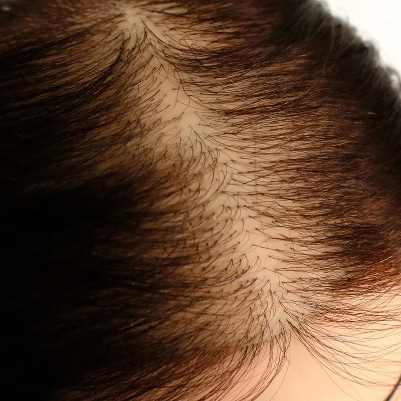 GL Hair Mesh Integration Hair Loss Training Mannequin Head Clamp