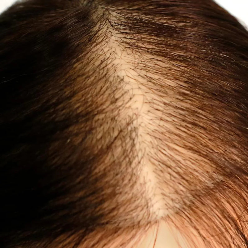 GL Hair Mesh Integration Hair Loss Training Mannequin Head Clamp